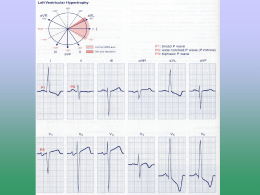 Miscellaneous EKG Changes Chapter 14
