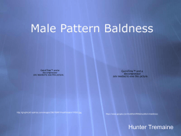 Male Pattern Baldness - Shorecrest Preparatory School
