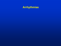 BS arrhythmias