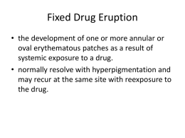 Erythema Multiforme Fixed Drug Eruption