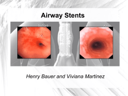 Airway Stents