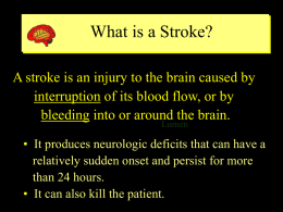 What is a Stroke?