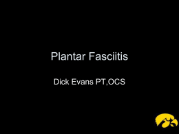 Plantar Fasciitis - Shotgun Approach