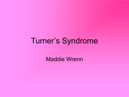 Turner’s Syndrome