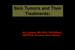 Skin Tumors and Their Treatments