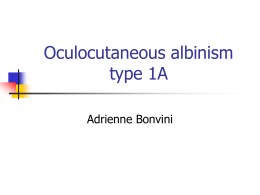 Oculocutaneous albinism type 1A
