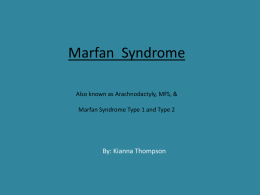 Marfan Syndromex - shsbiogeneticdisorders