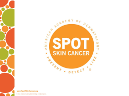 SPOT Skin Cancer Quiz Power Point
