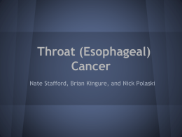 Throat (Esophageal) Cancer