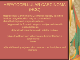 Hepatocellular Carcinoma(ppt بحث التخرج)