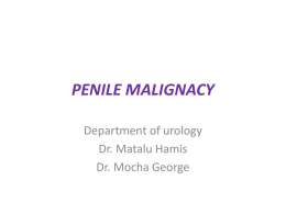 carcinoma of the penis - Bugando Medical Centre