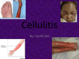 Cellulitis Powerpoint-Laraib