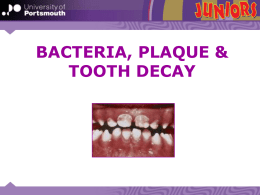 Presentation 4 – Bacteria and Decay