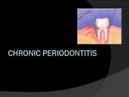 Chronic Periodontitis