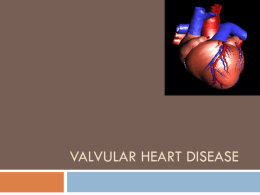 Valvular heart disease
