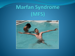 Marfan Syndrome - faculty at Chemeketa