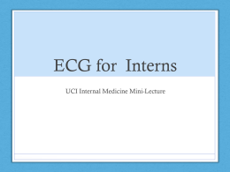 ECG for Interns