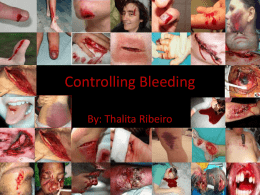 Controling Bleeding