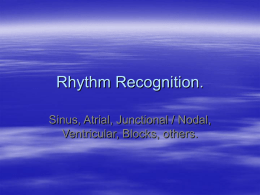 Rhythm Recognition.
