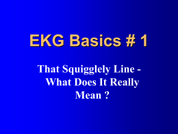 EKG Basics # 1 - Jan.ucc.nau.edu