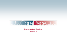 CorePace #5 - Pacemaker Basics
