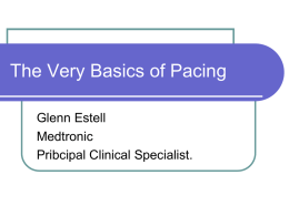 The Very Basic’s of Pacing