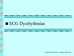 ECG Dysrhythmias - IHMC Public Cmaps (2)