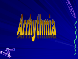 Ventricular arrhythmias - An