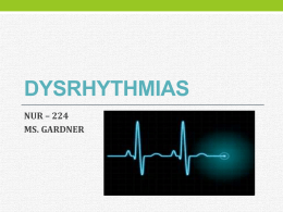 DYSRHYTHMIAS - Vincent's