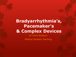 Bradyarrhythmia Pacing Devices