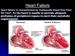 Heart failure PHL461