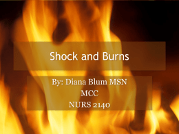 Shock and Burns