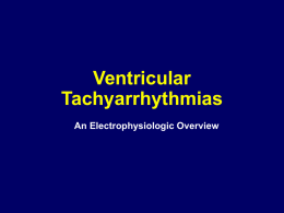 bYTEBoss Ventricular arrhythmias EP overview Medtronic