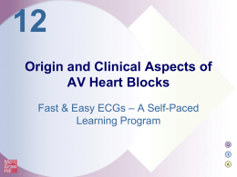 3 rd -Degree AV Heart Block - Pediatric Associates of Newnan