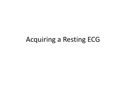 Acquiring an ECG