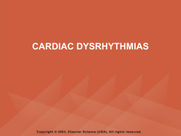 dysrhythmias