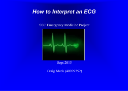 ECG Analysis - Antrim ED Meducation