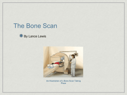 The Bone Scan