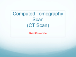 Computed Tomography Scan (CT Scan)