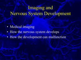 Lecture 2 Imaging, Brain Development