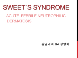 Sweet syndrome