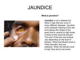 JAUNDICE - ASHWINI