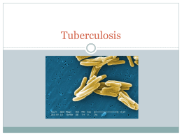 Tuberculosis - Public Health Tools