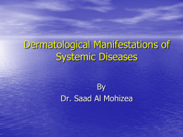 3-systemic diseases