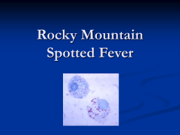 Rocky Mountain Spotted Fever