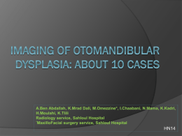 Imaging OF OTOMANDIBULAR DYSPLASIA: ABOUT 10 CASES