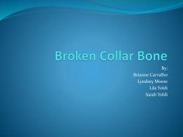 Broken Collar Bone