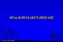 MI in KAWASAKI`S DISEASE