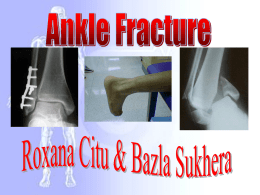 Ankle Fracture Roxana Citu & Bazla Sukhera The ankle is a hinge