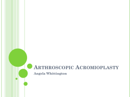 Arthroscopic Acromioplasty Overview